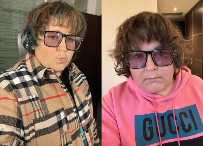Understanding Andy Milonakis' Youthful Look And Unique Condition Understanding Andy Milonakis' Youthful Look And Unique Condition